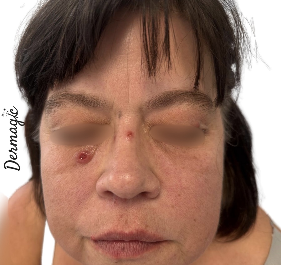 Photo clinique complémentaire